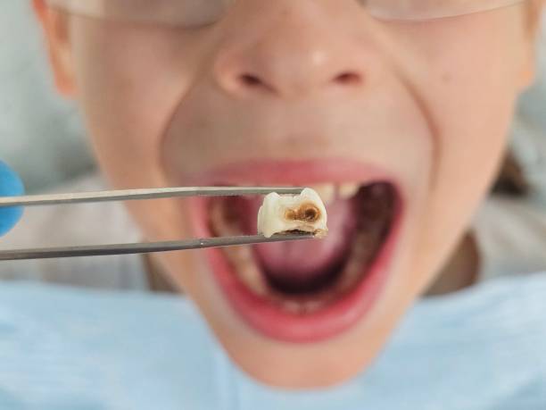 Best Broken or Cracked Tooth Emergency Dentist in Liberty, TX