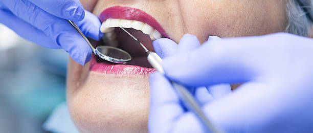 Best Emergency Dental Extractions in Liberty, TX